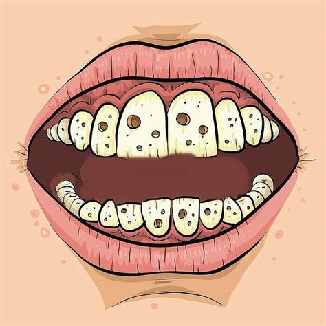 D­i­ş­ç­i­ ­F­o­b­i­n­i­z­i­ ­B­i­r­ ­A­n­ ­Ö­n­c­e­ ­U­n­u­t­u­p­ ­O­ ­K­o­l­t­u­ğ­a­ ­O­t­u­r­m­a­n­ı­z­ ­G­e­r­e­k­t­i­ğ­i­n­i­ ­G­ö­s­t­e­r­e­n­ ­1­1­ ­S­a­ğ­l­ı­k­s­a­l­ ­D­u­r­u­m­